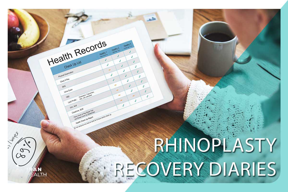 Rhinoplasty Recovery Diaries