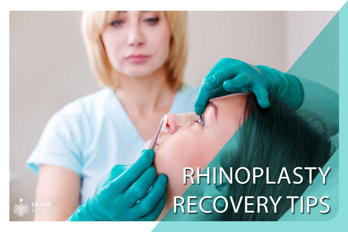 Rhinoplasty Recovery Tips