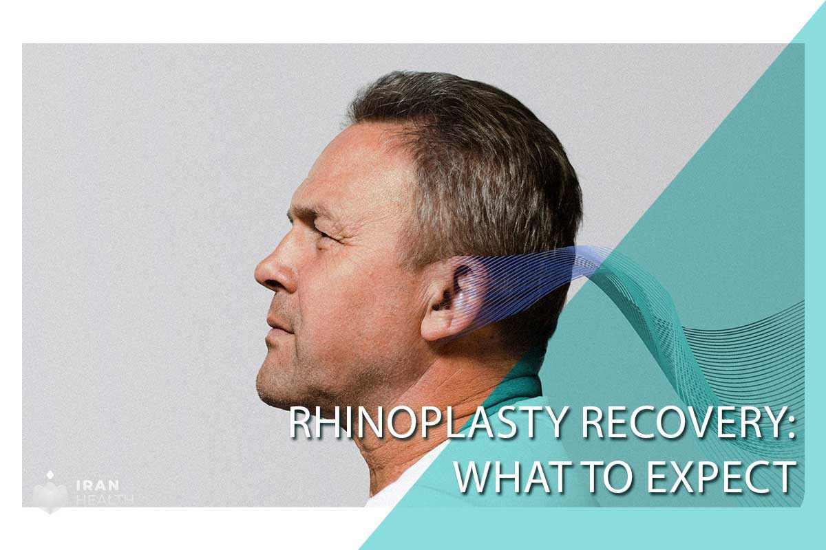 Rhinoplasty Recovery: What to Expect