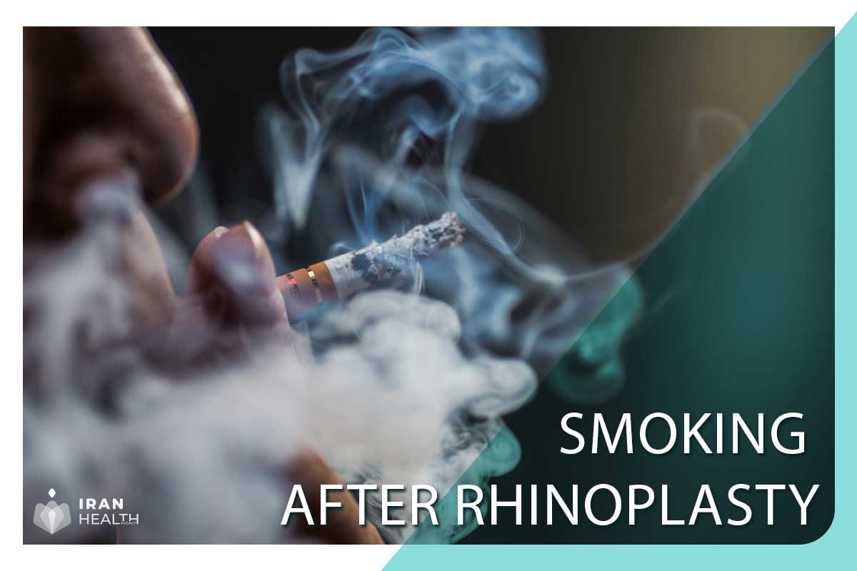 Smoking After rhinoplasty