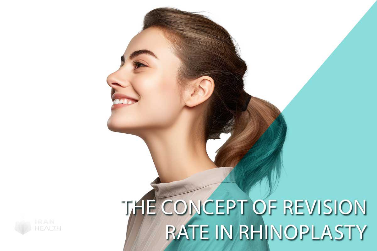 The Concept of Revision Rate in Rhinoplasty