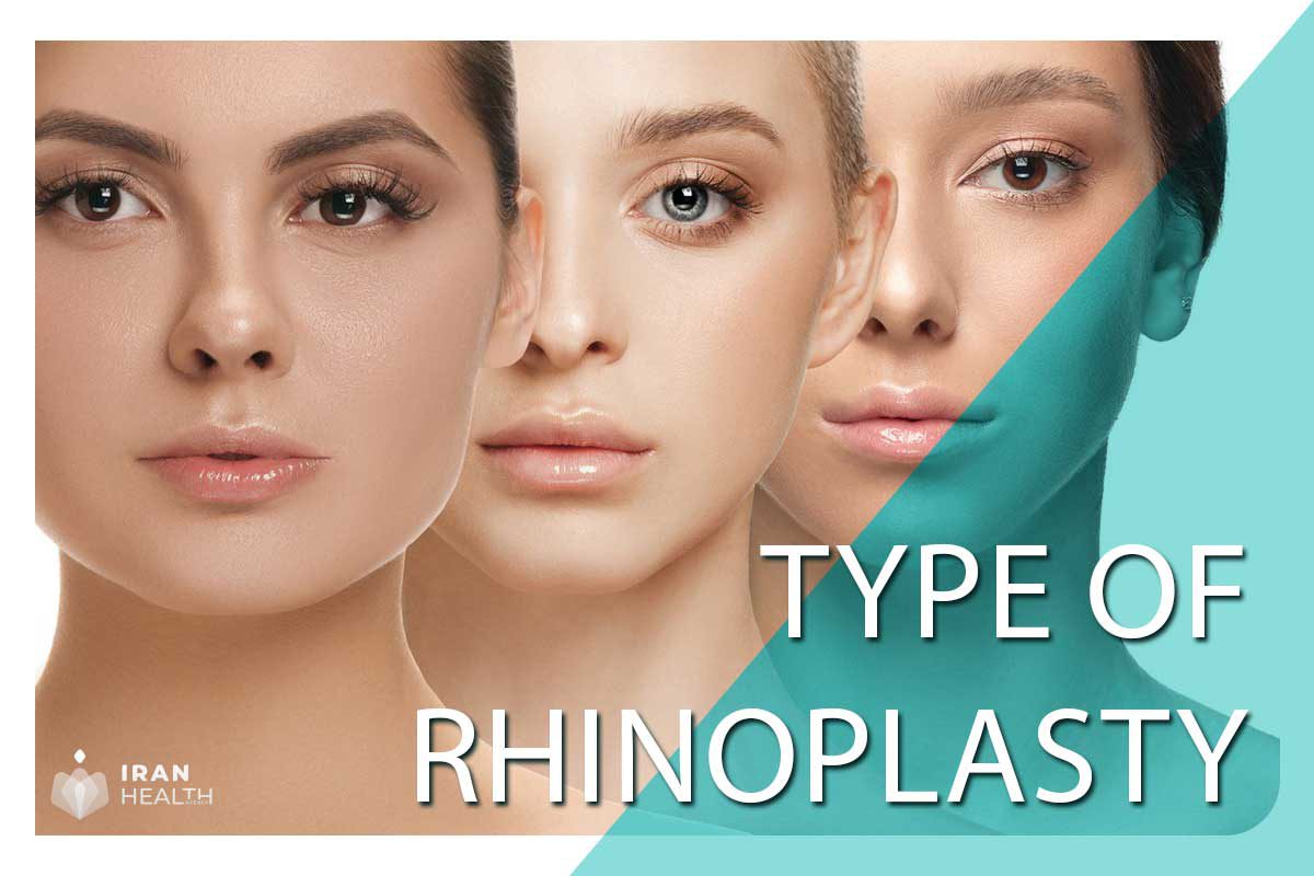 Type of rhinoplasty