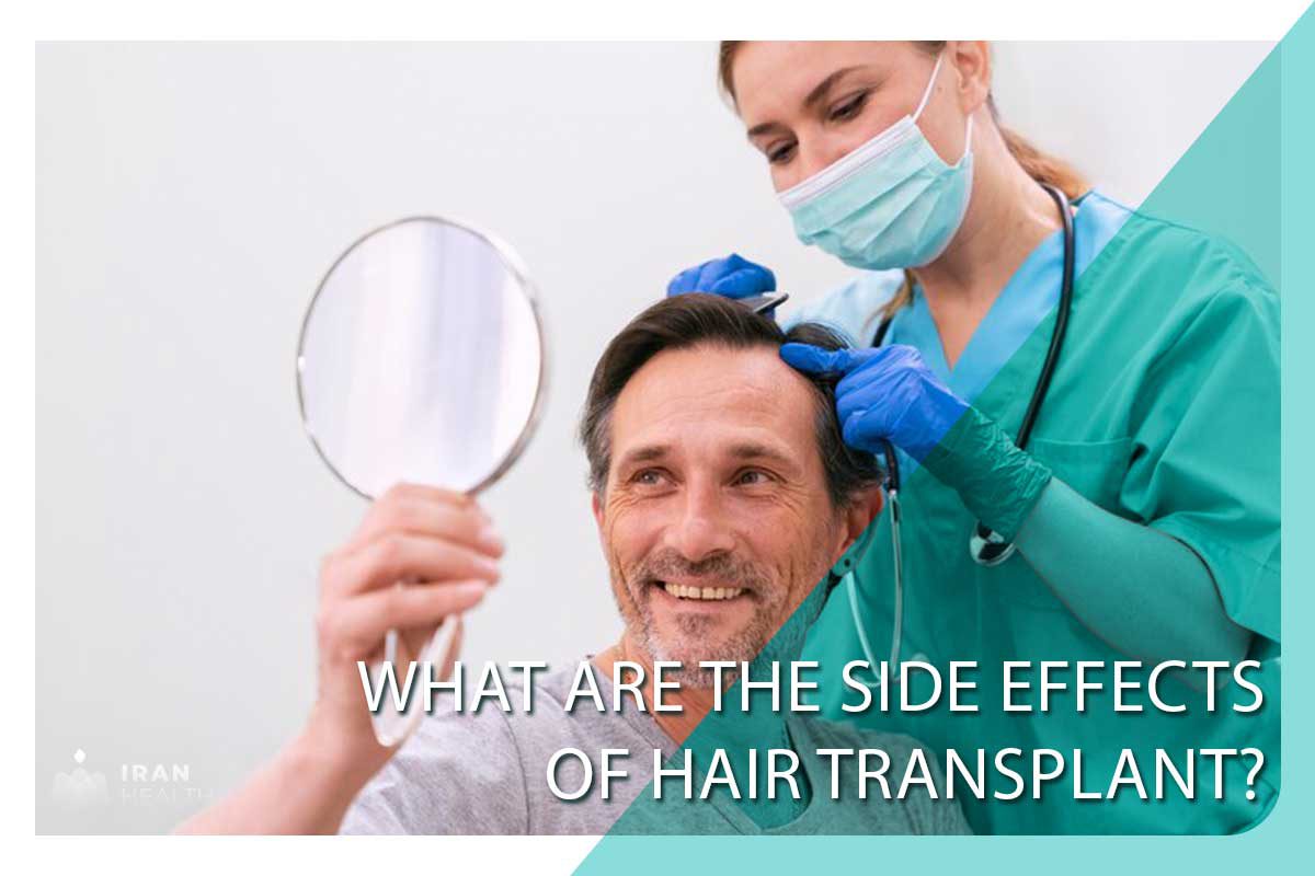 What are the side effects of hair transplant?