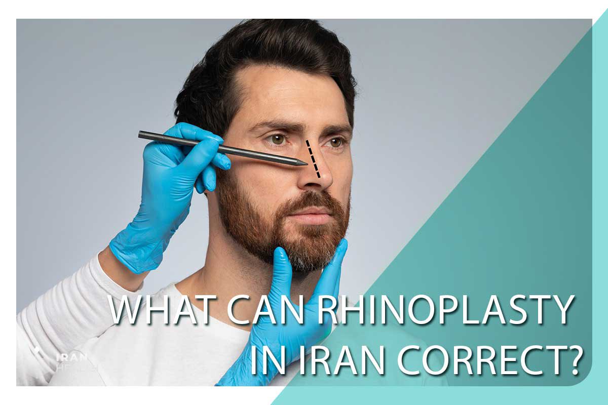 What can rhinoplasty in Iran correct