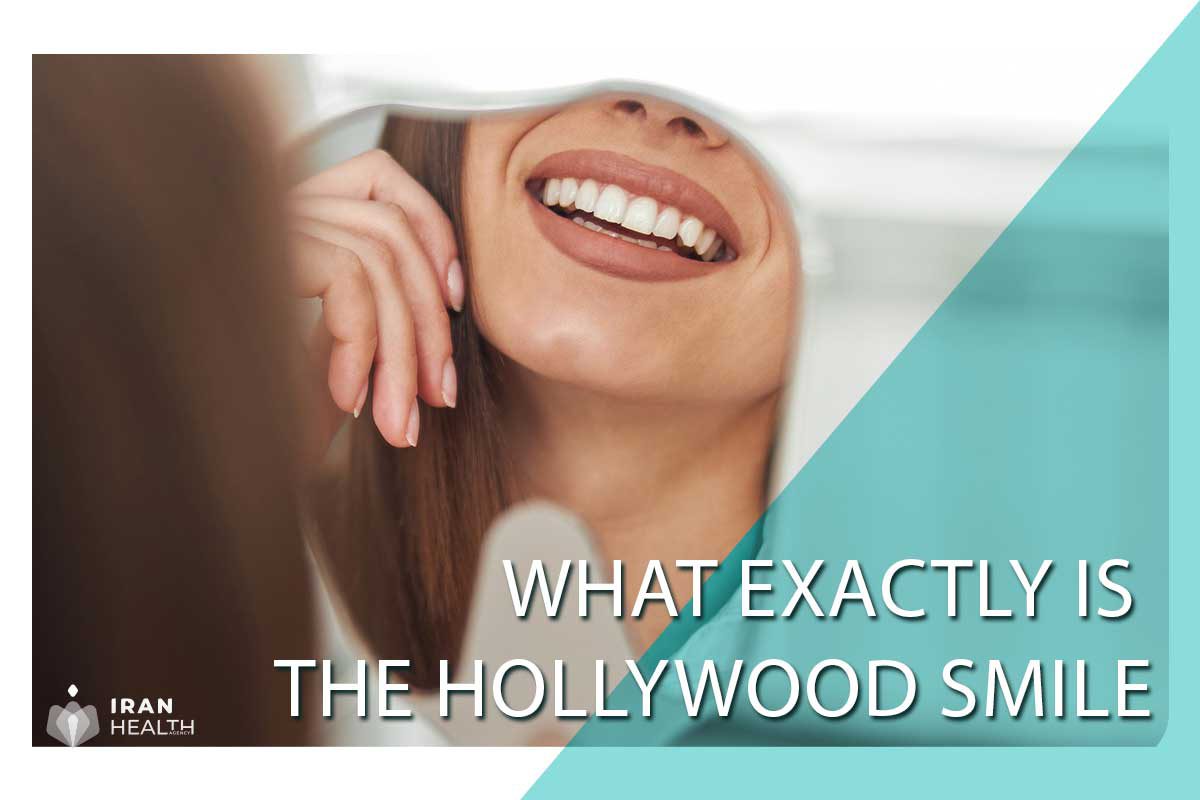What exactly is the Hollywood smile?