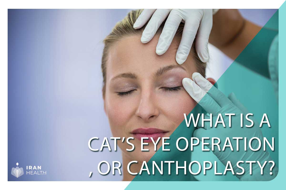 What is a cat’s eye operation, or canthoplasty