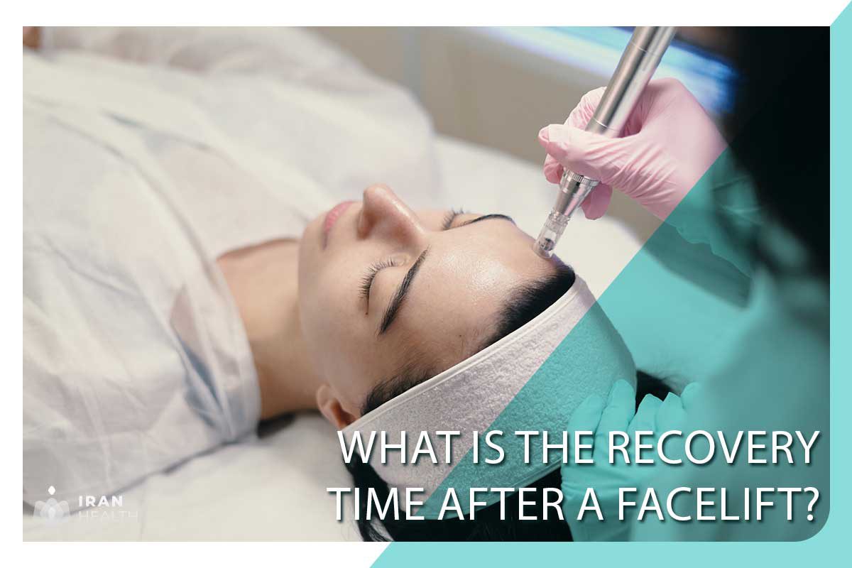 What is the recovery time after a facelift?