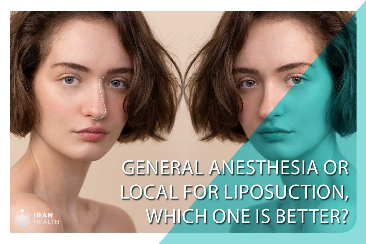 What is the success rate of rhinoplasty in Iran?