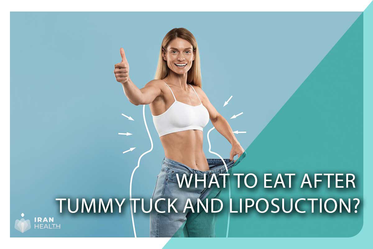 What to eat after tummy tuck and liposuction?