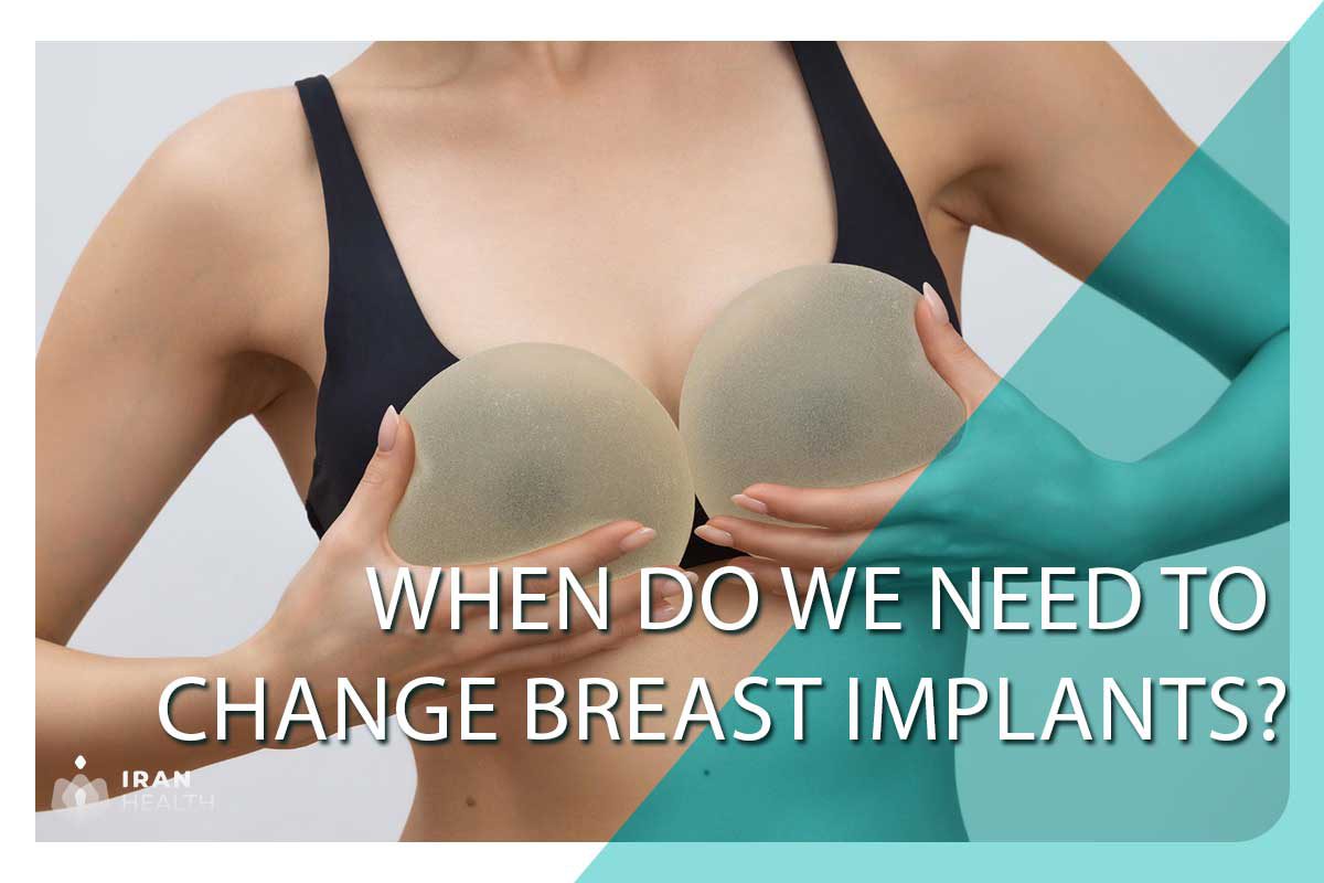 When do we need to change breast implants?