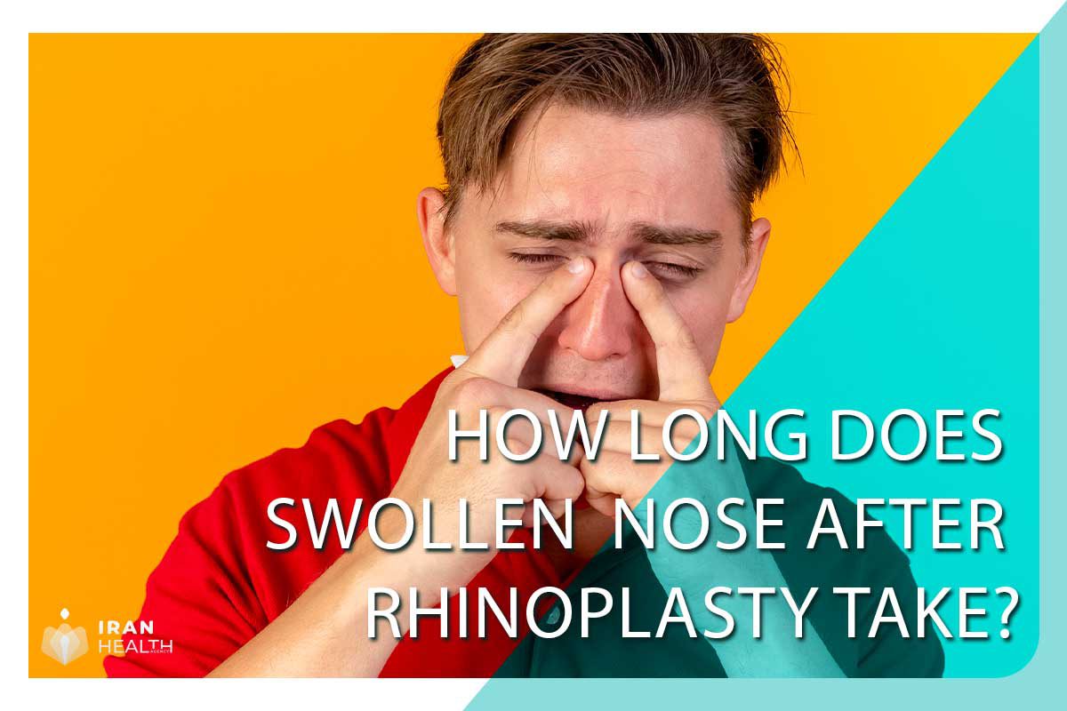 how long does swollen nose after rhinoplasty take?
